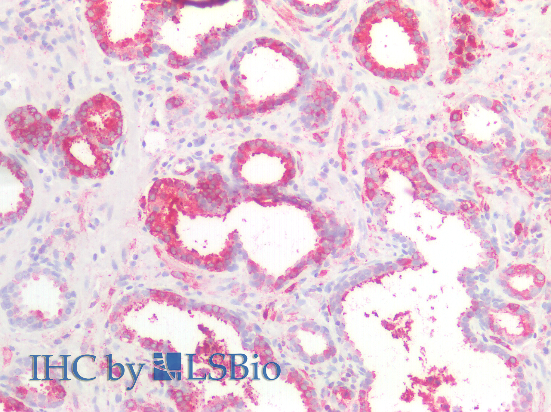 Polyclonal Antibody to Catenin Beta Interacting Protein 1 (CTNNbIP1)