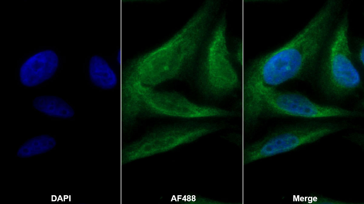 Polyclonal Antibody to Histone Deacetylase 4 (HDAC4)