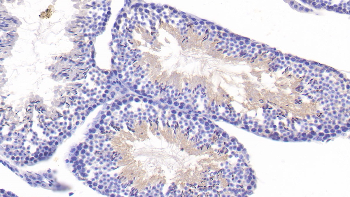 Polyclonal Antibody to Histone Deacetylase 6 (HDAC6)