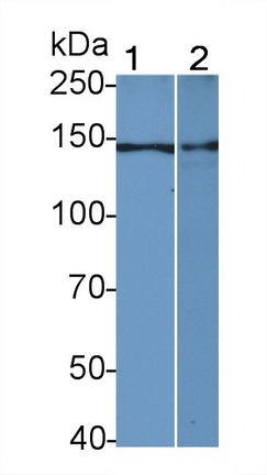 Polyclonal Antibody to Histone Deacetylase 6 (HDAC6)