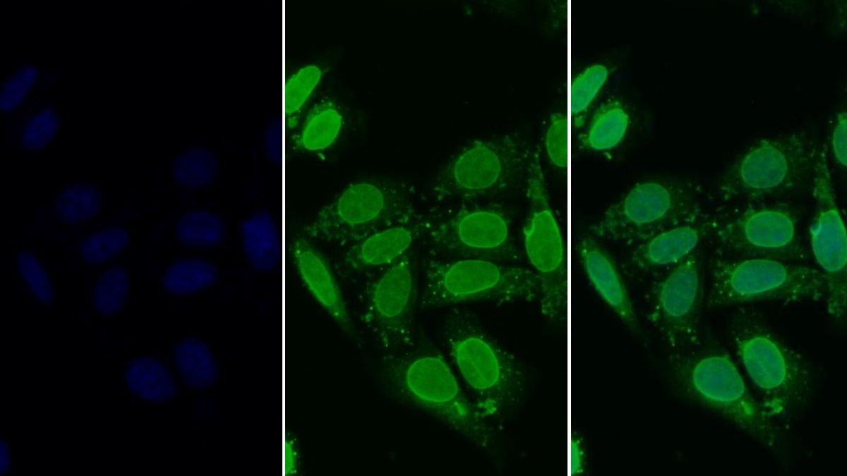 Polyclonal Antibody to Histone Deacetylase 6 (HDAC6)