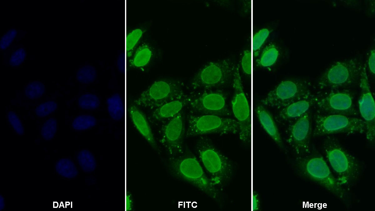 Polyclonal Antibody to Histone Deacetylase 6 (HDAC6)