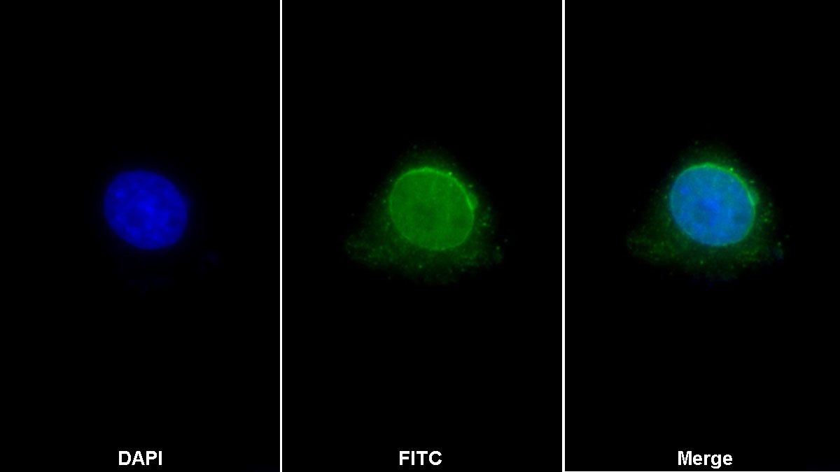 Polyclonal Antibody to Histone Deacetylase 6 (HDAC6)