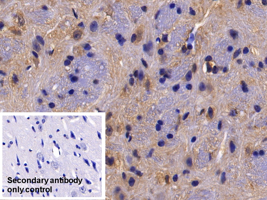 Polyclonal Antibody to Histone Deacetylase 6 (HDAC6)