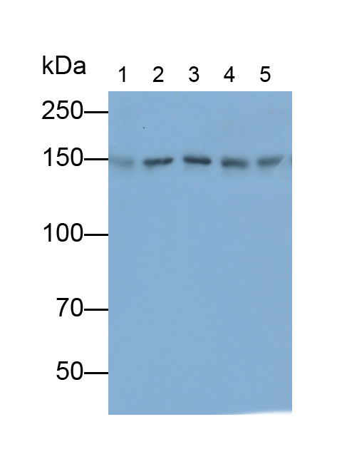 Polyclonal Antibody to Histone Deacetylase 6 (HDAC6)