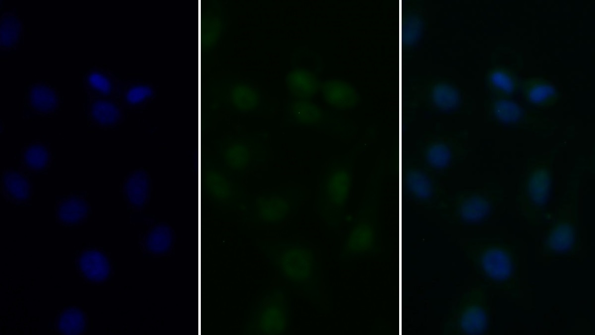 Polyclonal Antibody to Histone Deacetylase 6 (HDAC6)