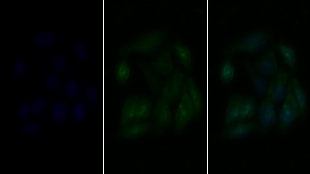 Polyclonal Antibody to Histone Deacetylase 6 (HDAC6)