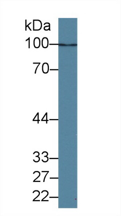 Polyclonal Antibody to Histone Deacetylase 9 (HDAC9)