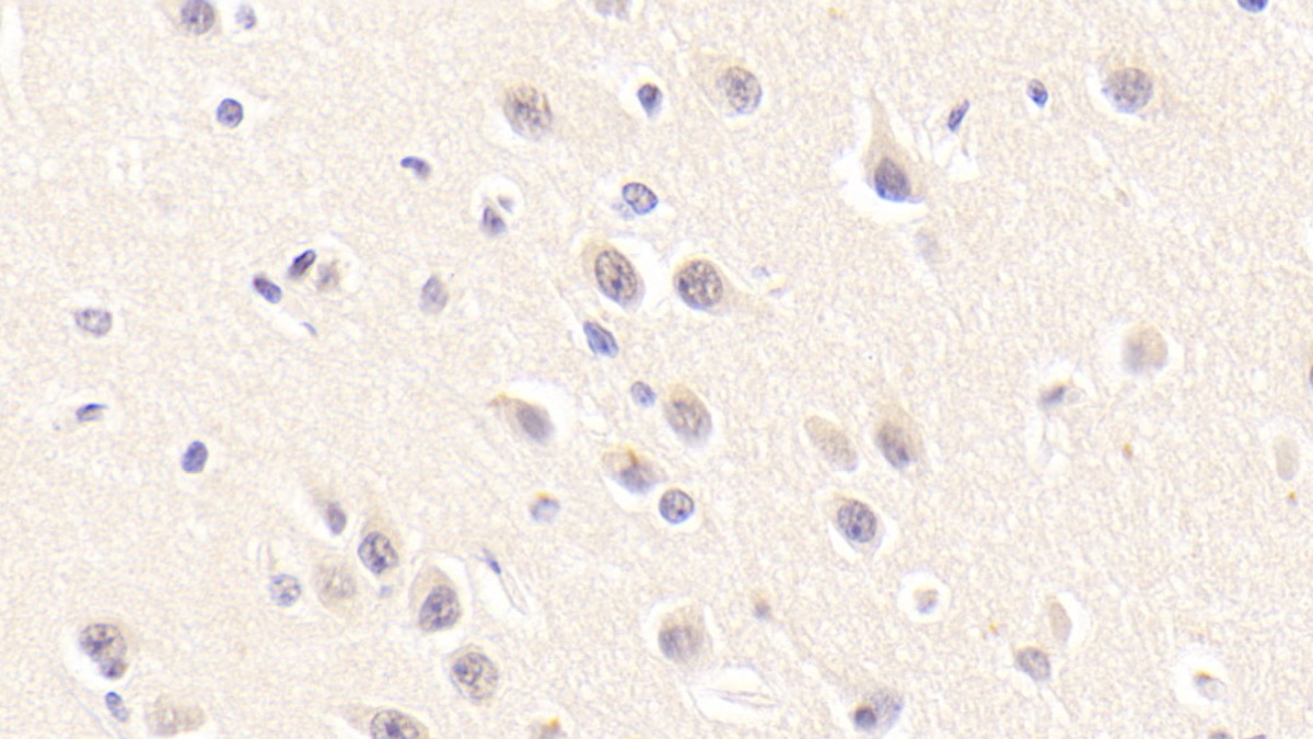 Polyclonal Antibody to Sirtuin 3 (SIRT3)