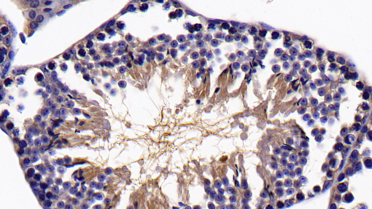 Polyclonal Antibody to Sirtuin 5 (SIRT5)