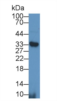 Polyclonal Antibody to Sirtuin 5 (SIRT5)