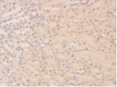 Polyclonal Antibody to Sirtuin 6 (SIRT6)