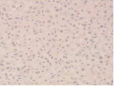 Polyclonal Antibody to Sirtuin 6 (SIRT6)