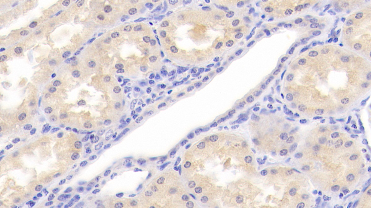 Polyclonal Antibody to Sirtuin 7 (SIRT7)