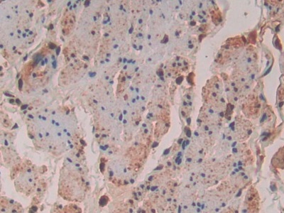 Polyclonal Antibody to Vav 3 Oncogene (VAV3)