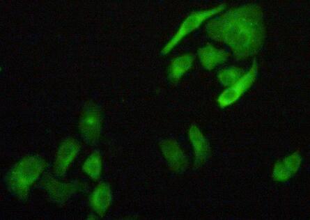 Polyclonal Antibody to Filamin B Beta (FLNb)