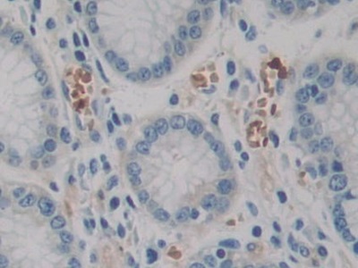 Polyclonal Antibody to Filamin B Beta (FLNb)