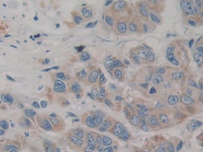 Polyclonal Antibody to Filamin B Beta (FLNb)