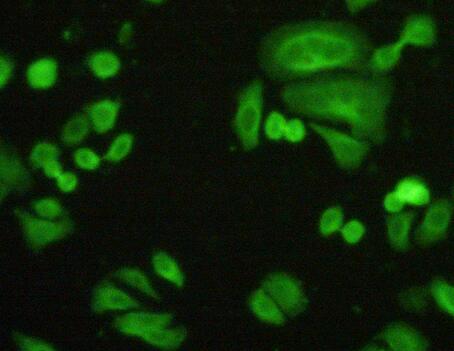 Polyclonal Antibody to Filamin B Beta (FLNb)