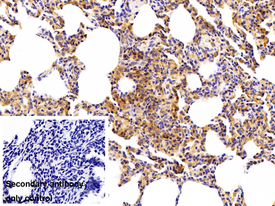 Polyclonal Antibody to Poly/rC Binding Protein 1 (PCBP1)