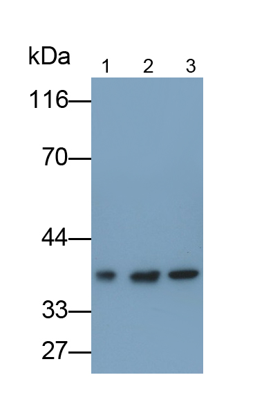 Polyclonal Antibody to Ribosomal Protein, Large, P0 (RPLP0)