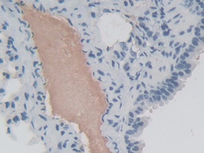 Polyclonal Antibody to Eukaryotic Translation Initiation Factor 2 Alpha Kinase 3 (EIF2aK3)