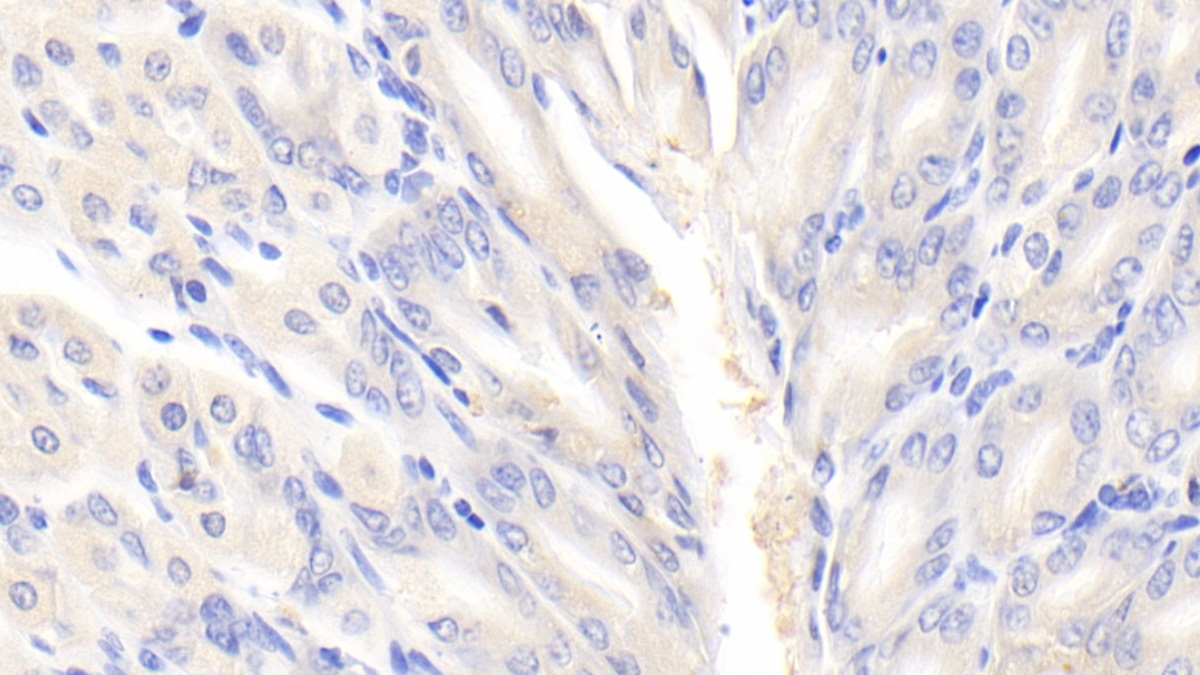 Polyclonal Antibody to Eukaryotic Translation Initiation Factor 2 Alpha Kinase 3 (EIF2aK3)