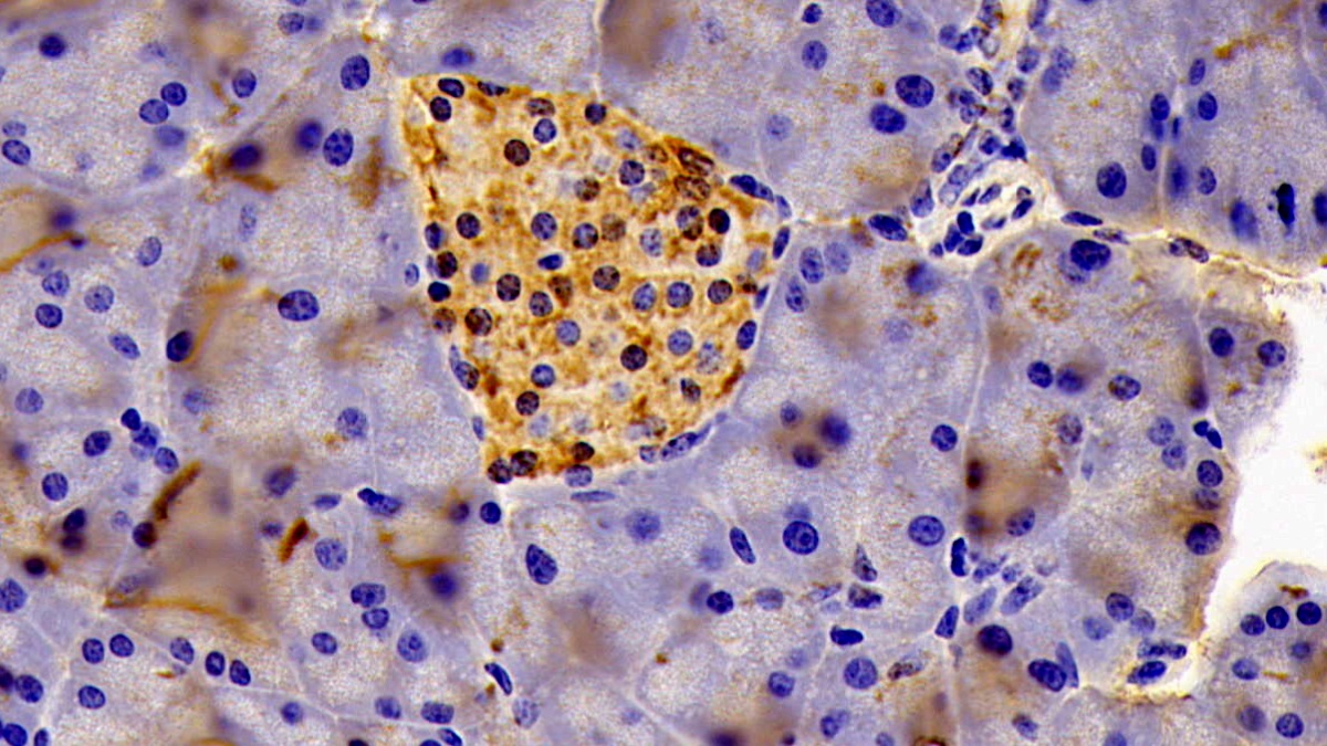 Polyclonal Antibody to Eukaryotic Translation Initiation Factor 2 Alpha Kinase 3 (EIF2aK3)