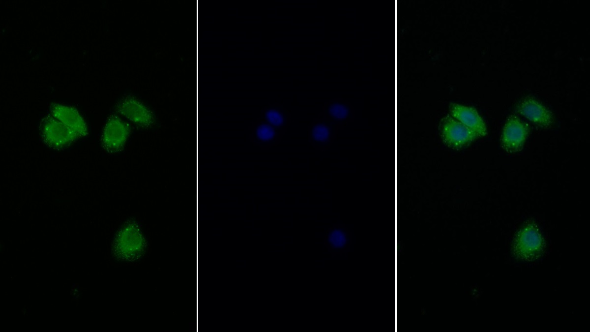 Polyclonal Antibody to Eukaryotic Translation Initiation Factor 2 Alpha Kinase 3 (EIF2aK3)