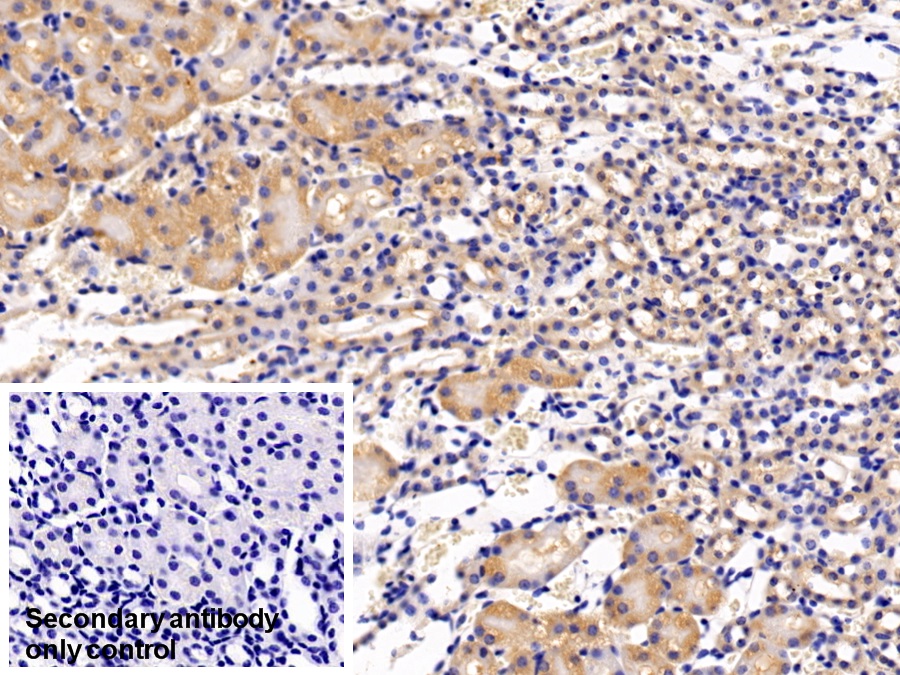 Polyclonal Antibody to Eukaryotic Translation Initiation Factor 2 Alpha Kinase 3 (EIF2aK3)