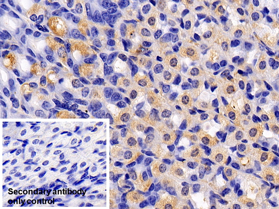 Polyclonal Antibody to Eukaryotic Translation Initiation Factor 2 Alpha Kinase 3 (EIF2aK3)