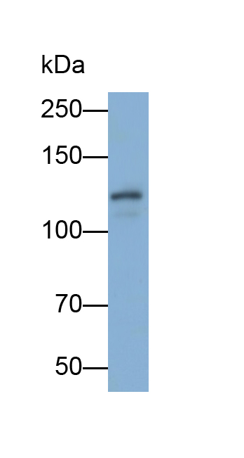 Polyclonal Antibody to Eukaryotic Translation Initiation Factor 2 Alpha Kinase 3 (EIF2aK3)