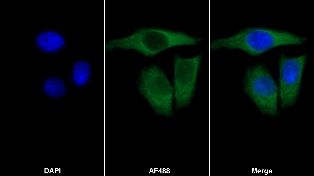 Polyclonal Antibody to Eukaryotic Translation Initiation Factor 3F (EIF3F)