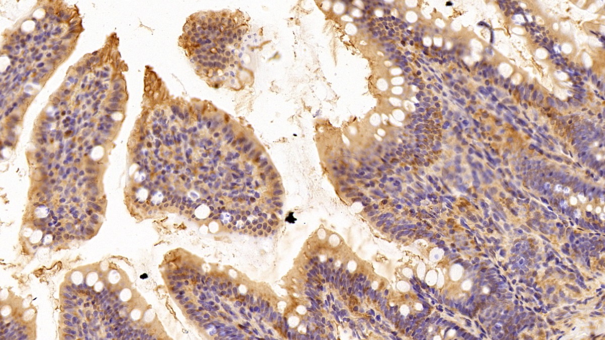 Polyclonal Antibody to Eukaryotic Translation Elongation Factor 1 Alpha 1 (EEF1a1)