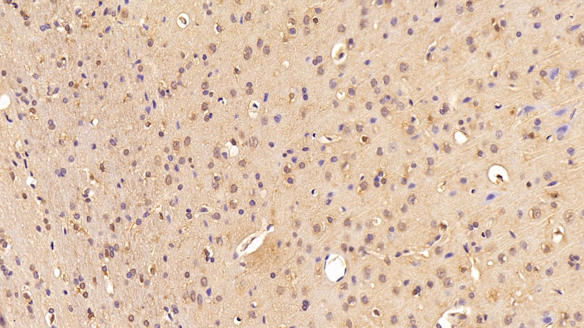 Polyclonal Antibody to Eukaryotic Translation Elongation Factor 1 Alpha 1 (EEF1a1)