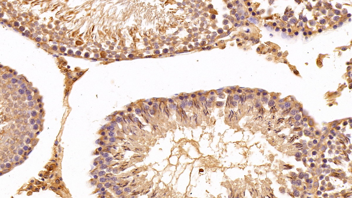 Polyclonal Antibody to Eukaryotic Translation Elongation Factor 1 Alpha 1 (EEF1a1)