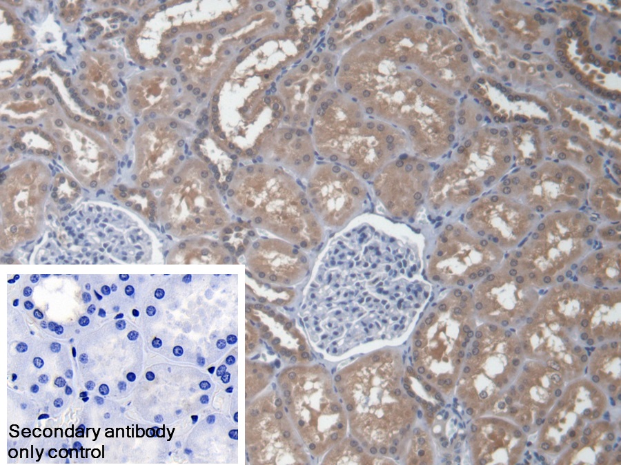 Polyclonal Antibody to Eukaryotic Translation Elongation Factor 1 Alpha 1 (EEF1a1)