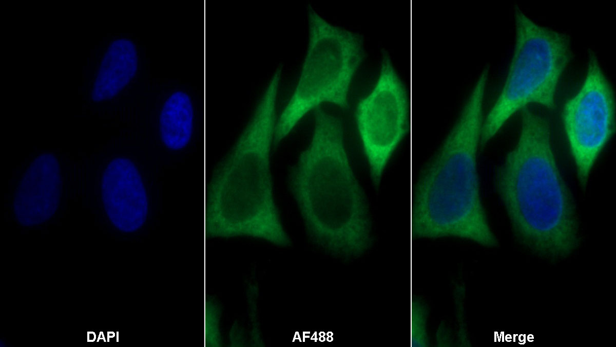 Polyclonal Antibody to Eukaryotic Translation Elongation Factor 1 Alpha 1 (EEF1a1)