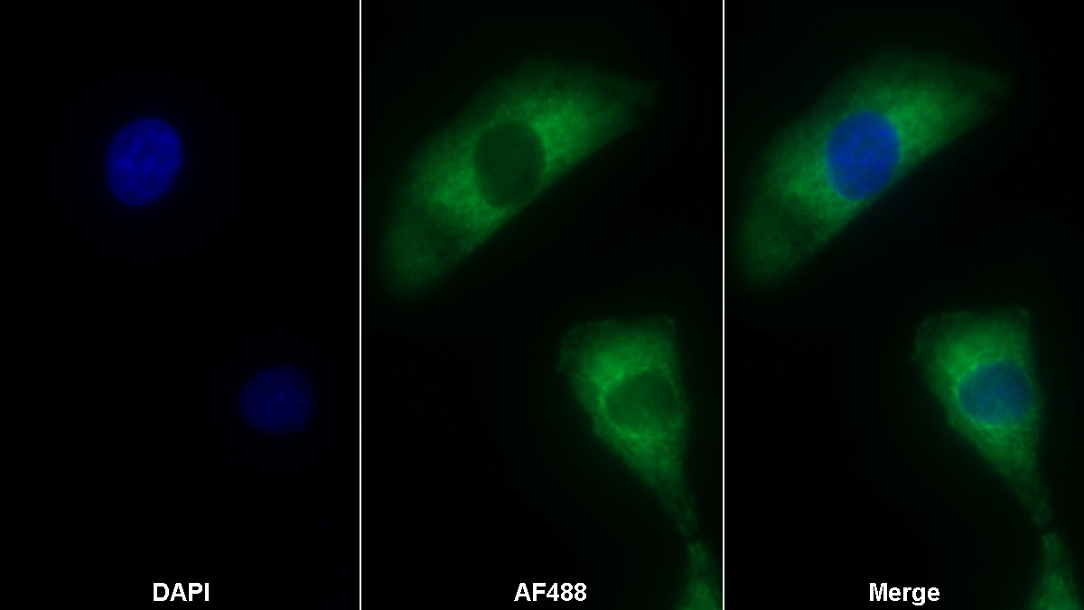 Polyclonal Antibody to Eukaryotic Translation Elongation Factor 1 Delta (EEF1d)