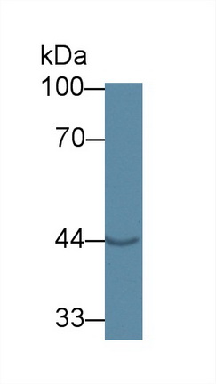 Polyclonal Antibody to G Protein Alpha 11 (GNa11)