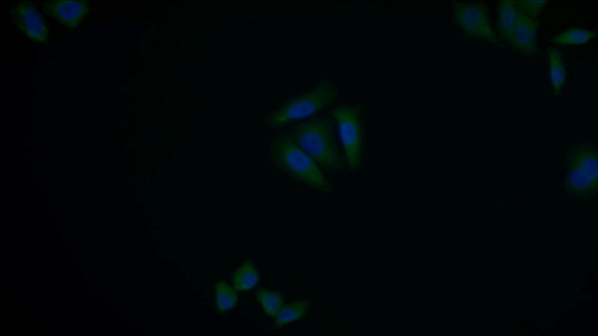 Polyclonal Antibody to G Protein Alpha 11 (GNa11)