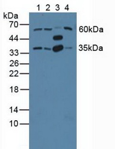 Polyclonal Antibody to G Protein Beta 2 (GNb2)