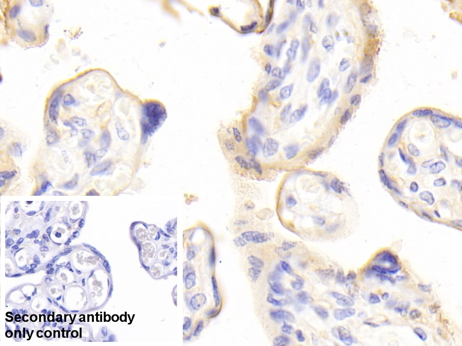 Polyclonal Antibody to G Protein Beta 2 (GNb2)