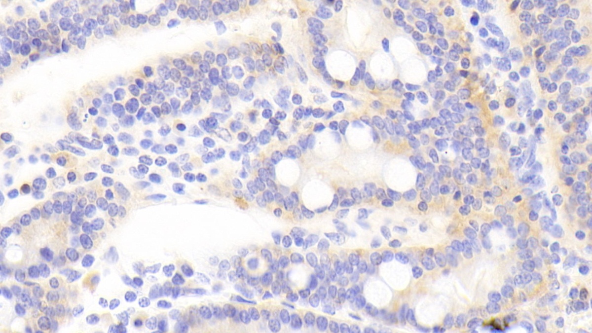 Polyclonal Antibody to Tight Junction Protein 2 (TJP2)