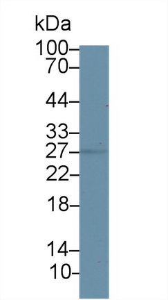 Polyclonal Antibody to 17-Beta-Hydroxysteroid Dehydrogenase Type 10 (HSD17b10)