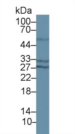 Polyclonal Antibody to 17-Beta-Hydroxysteroid Dehydrogenase Type 10 (HSD17b10)