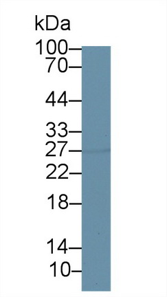 Polyclonal Antibody to 17-Beta-Hydroxysteroid Dehydrogenase Type 10 (HSD17b10)