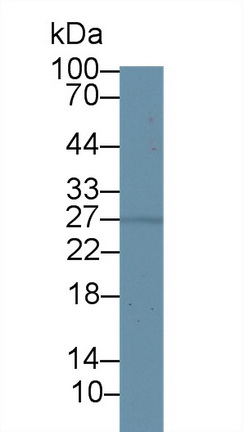 Polyclonal Antibody to 17-Beta-Hydroxysteroid Dehydrogenase Type 10 (HSD17b10)