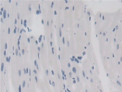 Polyclonal Antibody to 17-Beta-Hydroxysteroid Dehydrogenase Type 10 (HSD17b10)