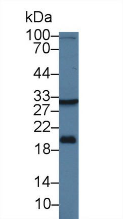 Polyclonal Antibody to 17-Beta-Hydroxysteroid Dehydrogenase Type 12 (HSD17b12)